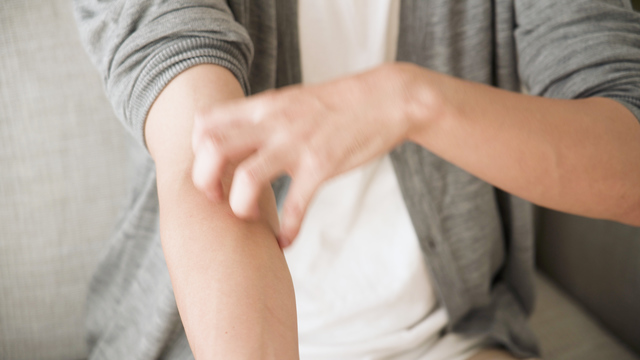 冬の乾燥肌・アトピー悪化の防ぎ方